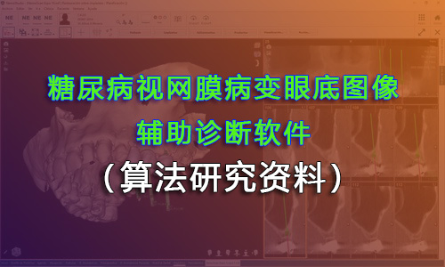 糖尿病視網(wǎng)膜病變眼底圖像輔助診斷軟件注冊對算法研究資料要求？（醫(yī)療器材軟件注冊）